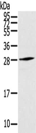 Gel: 12%SDS-PAGE,Lysate: 40 ug,,Primary antibody: CSB-PA693156(THYN1 Antibody) at dilution 1/800 dilution,Secondary antibody: Goat anti rabbit IgG at 1/8000 dilution,Exposure time: 30 seconds