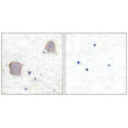 Immunohistochemical analysis of paraffin-embedded human brain tissue using GluR4 antibody.