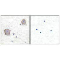 Immunohistochemical analysis of paraffin-embedded human brain tissue using GluR4 antibody.