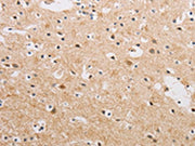 The image on the left is immunohistochemistry of paraffin-embedded Human brain tissue using CSB-PA693249(KAT5 Antibody) at dilution 1/20, on the right is treated with fusion protein. (Original magnification: ×200)