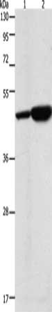 Gel: 10%SDS-PAGE, Lysate: 40 ug, Lane 1-2: 293T cells, Jurkat cells, Primary antibody: CSB-PA693524(ENO2 Antibody) at dilution 1/1250, Secondary antibody: Goat anti rabbit IgG at 1/8000 dilution, Exposure time: 30 seconds