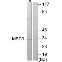 Western blot analysis of extracts from Jurkat cells, using MBD3 antibody.