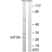 Western blot analysis of extracts from HeLa cells, using EIF3K antibody.