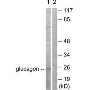 Western blot analysis of extracts from COS7 cells, using Glucagon antibody.