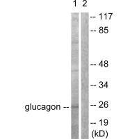 Western blot analysis of extracts from COS7 cells, using Glucagon antibody.