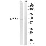 Western blot analysis of extracts from Jurkat cells, using DKK3 antibody.