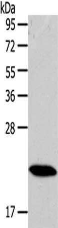 Gel: 10%SDS-PAGE,Lysate: 40 ug,,Primary antibody: CSB-PA694845(RAB18 Antibody) at dilution 1/100 dilution,Secondary antibody: Goat anti rabbit IgG at 1/8000 dilution,Exposure time: 5 minutes