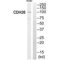 Western blot analysis of extracts from HuvEc cells, using Cytochrome P450 2C8 antiobdy.