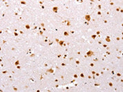 The image on the left is immunohistochemistry of paraffin-embedded Human brain tissue using CSB-PA695081(TBX2 Antibody) at dilution 1/32, on the right is treated with synthetic peptide. (Original magnification: ×200)