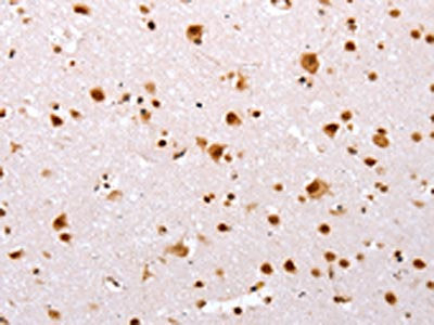 The image on the left is immunohistochemistry of paraffin-embedded Human brain tissue using CSB-PA695081(TBX2 Antibody) at dilution 1/32, on the right is treated with synthetic peptide. (Original magnification: ×200)