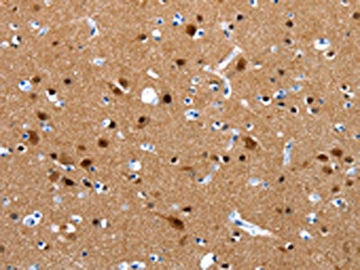 The image on the left is immunohistochemistry of paraffin-embedded Human brain tissue using CSB-PA695187(CRMP1 Antibody) at dilution 1/15, on the right is treated with synthetic peptide. (Original magnification: ×200)