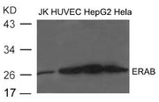 Western blot analysis of extract from JK, HUVEC, HepG2 and Hela cells using ERAB Antibody