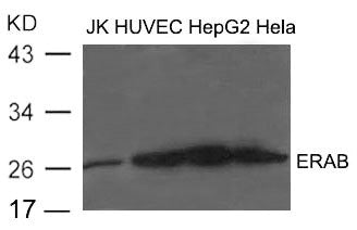 Western blot analysis of extract from JK, HUVEC, HepG2 and Hela cells using ERAB Antibody