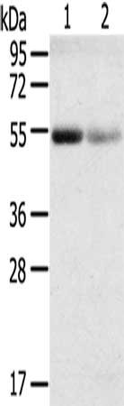 Gel: 8%SDS-PAGE, Lysate: 60 ug, Lane 1-2: Human kidney cancer tissue, Human kidney pericarcinous tissue, Primary antibody: CSB-PA695593(SLC17A1 Antibody) at dilution 1/200, Secondary antibody: Goat anti rabbit IgG at 1/8000 dilution, Exposure time...