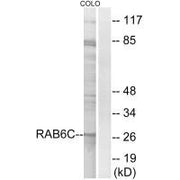Western blot analysis of extracts from COLO cells, using RAB6C antibody.