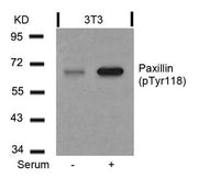 Western blot analysis of extracts from 3T3 cells untreated or treated with serum using Paxillin(Phospho-Tyr118) Antibody.