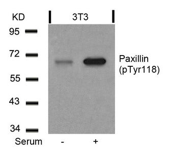 Western blot analysis of extracts from 3T3 cells untreated or treated with serum using Paxillin(Phospho-Tyr118) Antibody.