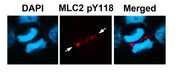 Immunofluorescence staining of methanol-fixed U87 cells using MLC2 (Phospho-Tyr118) Antibody.
