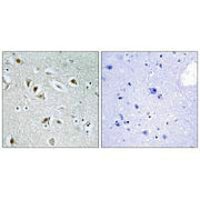 Immunohistochemistry analysis of paraffin-embedded human brain tissue, using CDKA2 antibody.