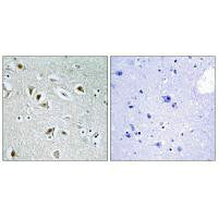 Immunohistochemistry analysis of paraffin-embedded human brain tissue, using CDKA2 antibody.