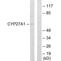 Western blot analysis of extracts from HeLa cells, using Cytochrome P450 27A1 antibody.