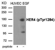 Western blot analysis of extracts from HUVEC cells treated with EGF using HER4 (Phospho-Tyr1284) Antibody.The lane on the left is treated with the antigen-specific peptide.