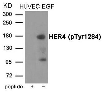 Western blot analysis of extracts from HUVEC cells treated with EGF using HER4 (Phospho-Tyr1284) Antibody.The lane on the left is treated with the antigen-specific peptide.