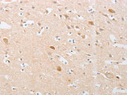 The image on the left is immunohistochemistry of paraffin-embedded Human brain tissue using CSB-PA696531(CDKN2AIP Antibody) at dilution 1/20, on the right is treated with fusion protein. (Original magnification: ×200)