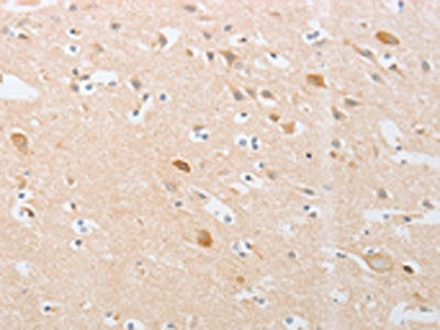 The image on the left is immunohistochemistry of paraffin-embedded Human brain tissue using CSB-PA696531(CDKN2AIP Antibody) at dilution 1/20, on the right is treated with fusion protein. (Original magnification: ×200)