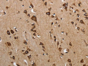 The image on the left is immunohistochemistry of paraffin-embedded Human brain tissue using CSB-PA697034(MYH11 Antibody) at dilution 1/25, on the right is treated with synthetic peptide. (Original magnification: ×200)