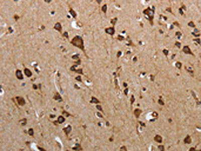 The image on the left is immunohistochemistry of paraffin-embedded Human brain tissue using CSB-PA697034(MYH11 Antibody) at dilution 1/25, on the right is treated with synthetic peptide. (Original magnification: ×200)