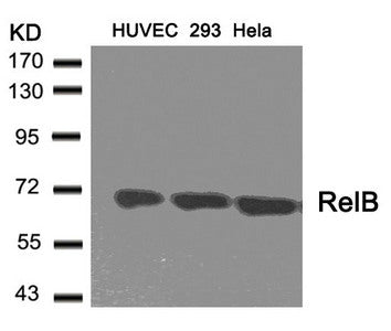 Western blot analysis of extracts from HUVEC, 293 and Hela cells using RelB(Ab-573) Antibody.
