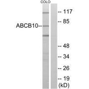 Western blot analysis of extracts from COLO cells, using ABCB10 antibody.