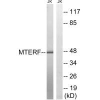 Western blot analysis of extracts from Jurkat cells, using MTERF antibody.