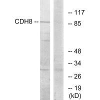 Western blot analysis of extracts from RAW264.7 cells, using CDH8 antibody.