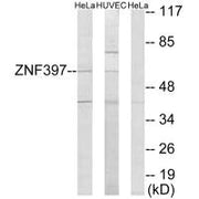 Western blot analysis of extracts from HeLa cells and HUVEC cells, using ZNF397 antibody.
