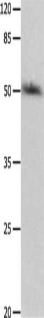 Gel: 10%SDS-PAGE, Lysate: 40 ug, Lane: HT29 cells, Primary antibody: CSB-PA697899(P2RY2 Antibody) at dilution 1/500, Secondary antibody: Goat anti rabbit IgG at 1/8000 dilution, Exposure time: 1 minute