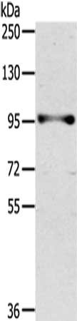 Gel: 6%SDS-PAGE,Lysate: 40 ug,,Primary antibody: CSB-PA697962(PROX1 Antibody) at dilution 1/300 dilution,Secondary antibody: Goat anti rabbit IgG at 1/8000 dilution,Exposure time: 1 minute