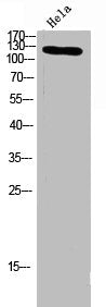 Western blot analysis of hela lysis using ITGA3 antibody. Antibody was diluted at 1:500. Secondary antibody was diluted at 1:20000