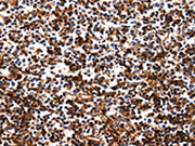 The image on the left is immunohistochemistry of paraffin-embedded Human tonsil tissue using CSB-PA698087(HP Antibody) at dilution 1/25, on the right is treated with fusion protein. (Original magnification: ×200)