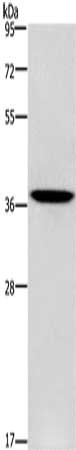 Gel: 8%SDS-PAGE, Lysate: 40 ug, Lane: Human fetal liver tissue, Primary antibody: CSB-PA698142(PRKAG1 Antibody) at dilution 1/250, Secondary antibody: Goat anti rabbit IgG at 1/8000 dilution, Exposure time: 1 minute