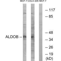 Western blot analysis of extracts from MCF-7 cells and HUVEC cells, using ALDOB antibody.