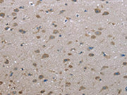The image on the left is immunohistochemistry of paraffin-embedded Human brain tissue using CSB-PA699536(FAP Antibody) at dilution 1/30, on the right is treated with fusion protein. (Original magnification: ×200)