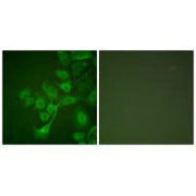 Immunofluorescence analysis of A549 cells, using TIMP2 antibody.
