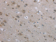 The image on the left is immunohistochemistry of paraffin-embedded Human brain tissue using CSB-PA699881(EGFL8 Antibody) at dilution 1/40, on the right is treated with fusion protein. (Original magnification: ×200)