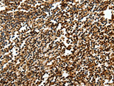 The image on the left is immunohistochemistry of paraffin-embedded Human tonsil tissue using CSB-PA699917(SOX13 Antibody) at dilution 1/50, on the right is treated with synthetic peptide. (Original magnification: ×200)