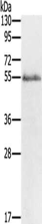 Gel: 8%SDS-PAGE, Lysate: 60 ug, Lane: Human placenta tissue, Primary antibody: CSB-PA700961(GJA9 Antibody) at dilution 1/200, Secondary antibody: Goat anti rabbit IgG at 1/8000 dilution, Exposure time: 5 minutes