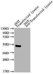 Western Blot Positive WB detected in: pat 293T Transfected lysate, 293T non-Transfected lysate All lanes: pat antibody at 1:2000 Secondary Goat polyclonal to rabbit IgG at 1/50000 dilution Predicted band size: 49 kDa Observed band size: 49 kDa