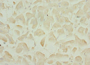 Immunohistochemistry of paraffin-embedded human heart tissue using CSB-PA701578ESR1HU at dilution of 1:100