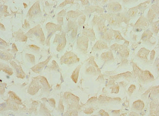 Immunohistochemistry of paraffin-embedded human heart tissue using CSB-PA701578ESR1HU at dilution of 1:100
